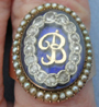 B Ring Top