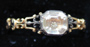 Skull Rococo Ring Front